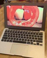  MacBook Air   11